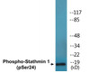 Stathmin 1 Phospho-Ser24 Colorimetric Cell-Based ELISA Kit