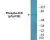 ICK Phospho-Tyr159 Colorimetric Cell-Based ELISA Kit
