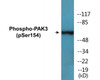 PAK3 Phospho-Ser154 Colorimetric Cell-Based ELISA Kit