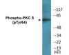 PKC delta Phospho-Tyr64 Colorimetric Cell-Based ELISA Kit