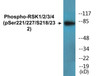 RSK1/2/3/4 Phospho-Ser221/227/S218/232 Colorimetric Cell-Based ELISA Kit
