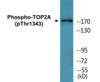 TOP2A Phospho-Thr1343 Colorimetric Cell-Based ELISA Kit