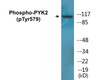 PYK2 Phospho-Tyr579 Colorimetric Cell-Based ELISA Kit