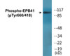 EPB41 Phospho-Tyr660/418 Colorimetric Cell-Based ELISA Kit