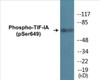 TIF-IA Phospho-Ser649 Colorimetric Cell-Based ELISA Kit
