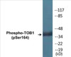 TOB1 Phospho-Ser164 Colorimetric Cell-Based ELISA Kit
