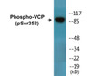 VCP Phospho-Ser352 Colorimetric Cell-Based ELISA Kit