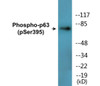 p63 Phospho-Ser395 Colorimetric Cell-Based ELISA Kit