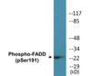 FADD Phospho-Ser191 Colorimetric Cell-Based ELISA Kit