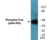 Fos Phospho-Ser362 Fluorometric Cell-Based ELISA Kit
