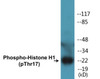 Histone H1 Phospho-Thr17 Fluorometric Cell-Based ELISA Kit