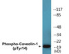 Caveolin-1 Phospho-Tyr14 Fluorometric Cell-Based ELISA Kit