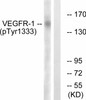 VEGFR1 Phospho-Tyr1333 Fluorometric Cell-Based ELISA Kit