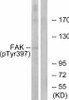 FAK Phospho-Tyr397 Fluorometric Cell-Based ELISA Kit