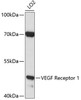 Cardiovascular Antibodies Anti-VEGF Receptor 1 Antibody CAB0058