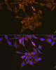 Cardiovascular Antibodies Anti-VEGF Receptor 1 Antibody CAB0058