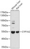Metabolism Antibodies 1 Anti-CYP1A2 Antibody CAB0062