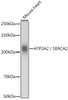 Cell Biology Antibodies 1 Anti-ATP2A2 / SERCA2 Antibody CAB0098