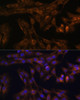 Cell Biology Antibodies 1 Anti-FoxO3a Antibody CAB0102