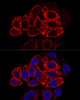 Cell Biology Antibodies 1 Anti-KRT17 Antibody CAB0123