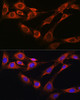 Signal Transduction Antibodies 2 Anti-NCSTN Antibody CAB0128