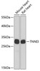 Cell Biology Antibodies 1 Anti-TNNI3 Antibody CAB0152