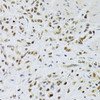 Cell Cycle Antibodies 1 Anti-Rad50 Antibody CAB0182
