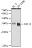 Cell Biology Antibodies 1 Anti-GDF15 Antibody CAB0185