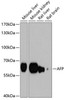 Cell Biology Antibodies 1 Anti-AFP Antibody CAB0200