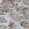 Cell Death Antibodies 1 Anti-APP Antibody CAB0206