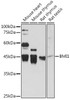 Epigenetics and Nuclear Signaling Antibodies 1 Anti-BMI1 Antibody CAB0211