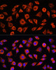 Immunology Antibodies 1 Anti-CRP Antibody CAB0224