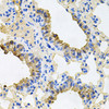 Cell Biology Antibodies 1 Anti-IGF1R Antibody CAB0243