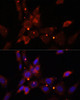 Epigenetics and Nuclear Signaling Antibodies 1 Anti-IKKEpsilon Antibody CAB0244