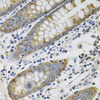 Cell Death Antibodies 1 Anti-KRT20 Antibody CAB0248