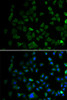 Cell Biology Antibodies 1 Anti-MAP2K1 Antibody CAB0252