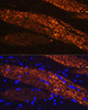 Cell Biology Antibodies 1 Anti-NEFL Antibody CAB0257