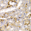 Cell Biology Antibodies 1 Anti-NEFL Antibody CAB0257