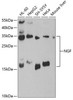 Cell Biology Antibodies 1 Anti-NGF Antibody CAB0258