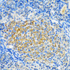 Autophagy Antibodies Anti-SIRT2 Antibody CAB0273