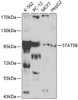 Epigenetics and Nuclear Signaling Antibodies 1 Anti-STAT5B Antibody CAB0275
