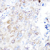 Cardiovascular Antibodies Anti-VEGFA Antibody CAB0280