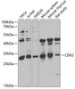 Cell Cycle Antibodies 1 Anti-CDK2 Antibody CAB0294