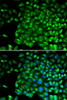 Cell Death Antibodies 1 Anti-TNFRSF1B Antibody CAB0387