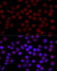 Cell Biology Antibodies 1 Anti-IKKAlpha Antibody CAB0423