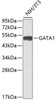 Epigenetics and Nuclear Signaling Antibodies 1 Anti-GATA1 Antibody CAB0475