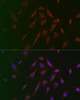 Immunology Antibodies 1 Anti-TSC2 Antibody CAB0492