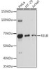 Cell Biology Antibodies 1 Anti-RELB Antibody CAB0519