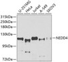 Immunology Antibodies 1 Anti-NEDD4 Antibody CAB0552
