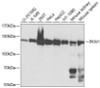 Epigenetics and Nuclear Signaling Antibodies 1 Anti-PKN1 Antibody CAB0553